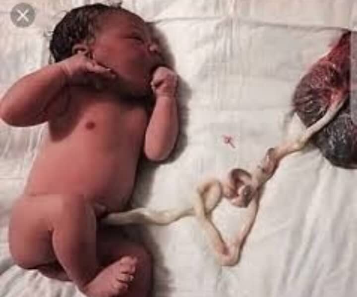 Understanding the Sacred Symbolism of the Placenta in Igbo Culture || Nnewi City